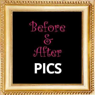 Before & After Pics Before & After Pics